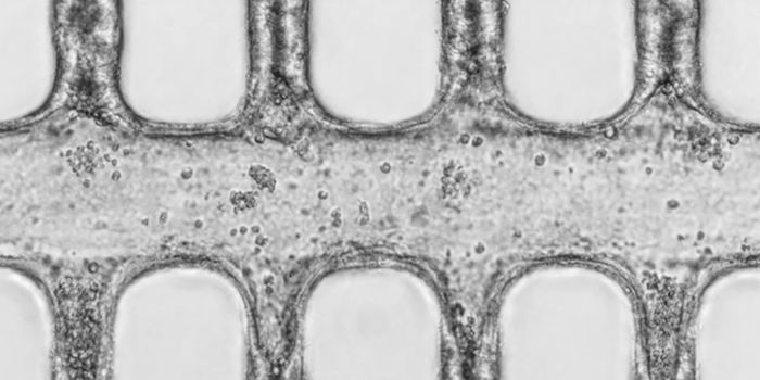 Researchers Take Organoids a Step Further
