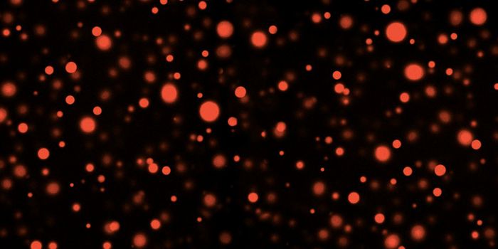 Modeling the Separation of Liquids in Cells