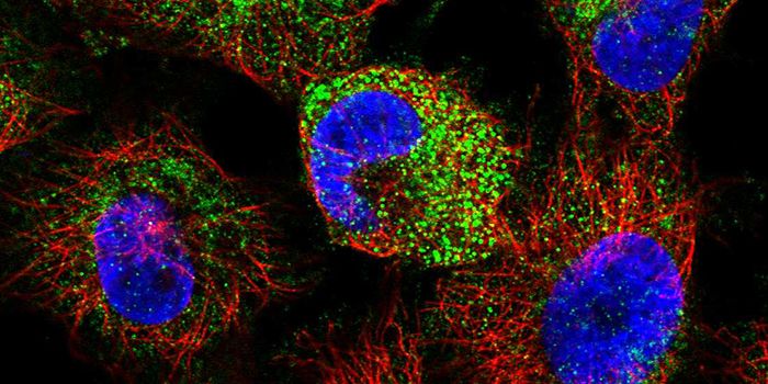 Gene Associated with Rare Disease Determines How Body Processes Pain