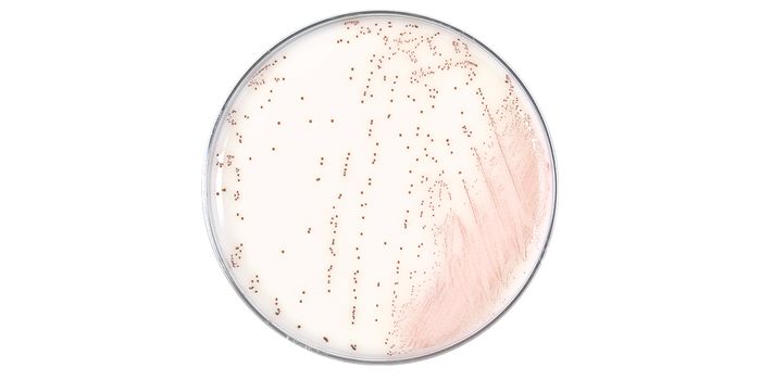 It's Strep Throat Season