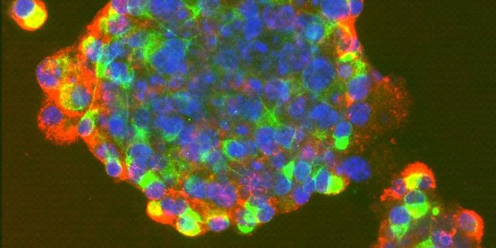 Gene Essential for Reprogramming Human Amniotic Stem Cells