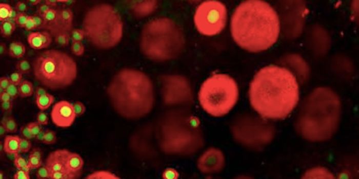 Likely Cause of Polycystic Ovarian Syndrome ID'ed