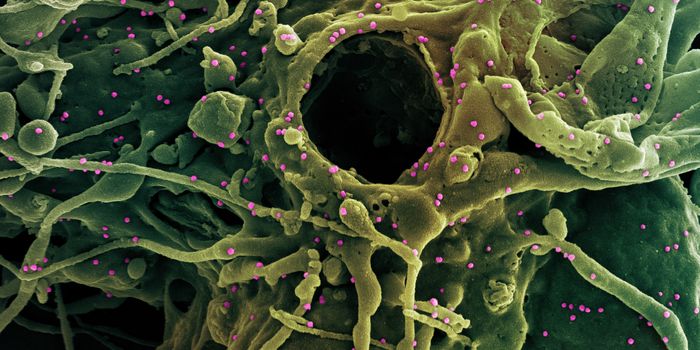 COVID-19 Linked to Hemorrhages in Fetal Brains