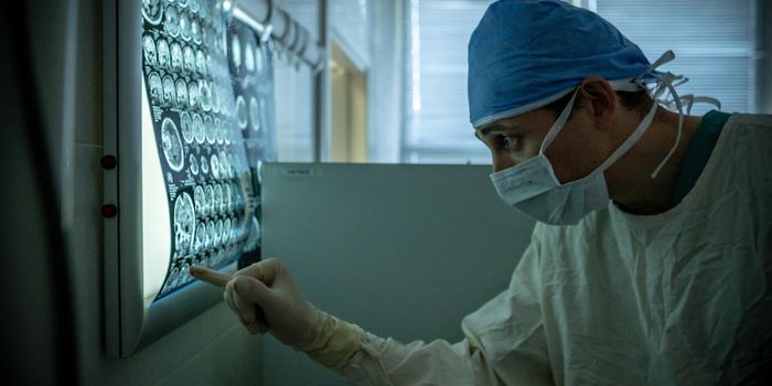 Pancreatic Cancer is Difficult to Detect in its Curable Early Stages: AI Could Soon Change This