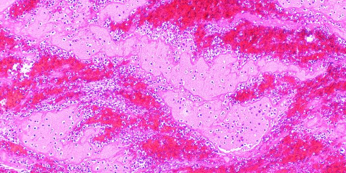 A Vaccine for Heart Disease?