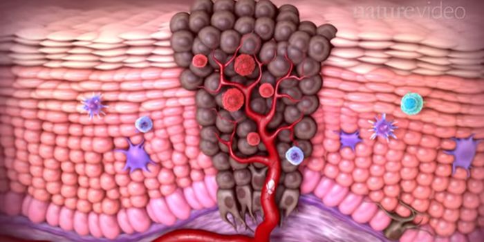 Cancer Immunotherapy