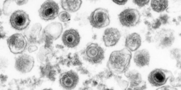 Epstein-Barr Virus Symptoms Driven By Host Immune Response