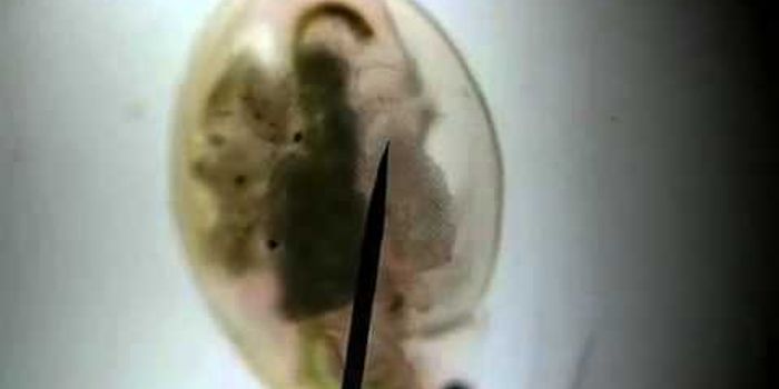 Microbes under the microscope