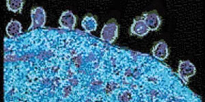 HIV Vaccine Successful in Non-human Primates