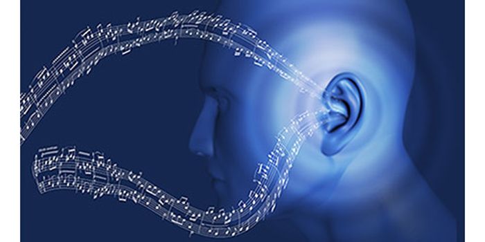 Simplifying Music for Cochlear Implants