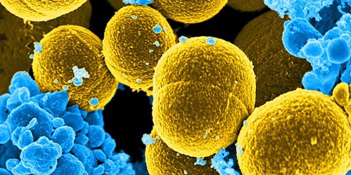 Staph Bacteria can Directly Affect Neurons to Cause Itch