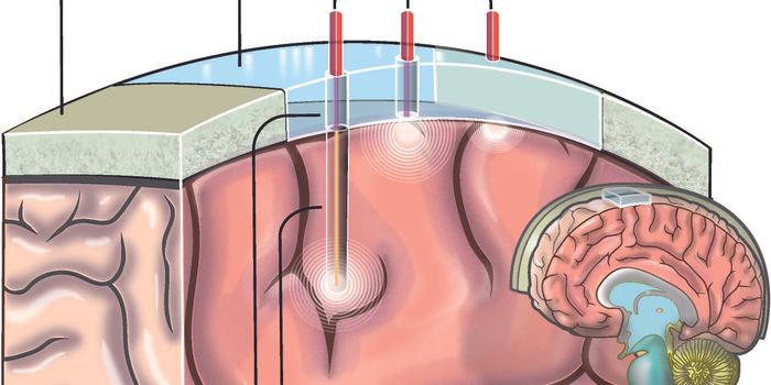 Scientists One Step Closer to a Brain Window, Literally