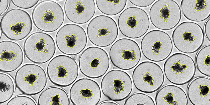 From Plate to Insight: Simplifying 3D Cell Culture Workflows