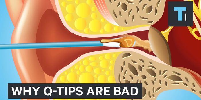 The Dangers of Q-Tips and Hearing Loss