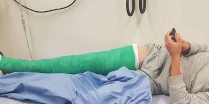 Any Fracture can Lead to Bone Density Losses Everywhere