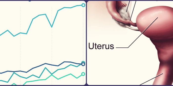 Uterine Cancer Rises, Especially Among Black Women
