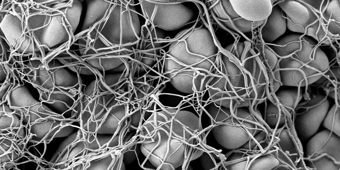 Blood Cancer Takes A One-Two Punch: Molecular Pathways of MPN Exposed