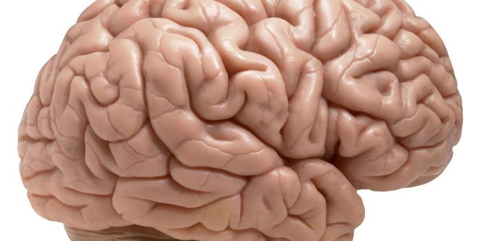 Study of Thousands of Brains Reveals Tau as Driver of Alzheimer's