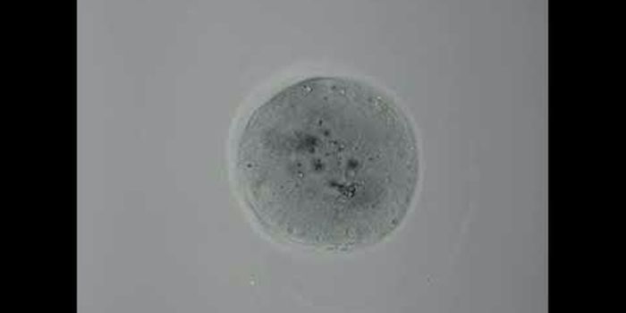 Scientists Link Three Genes to Miscarriage