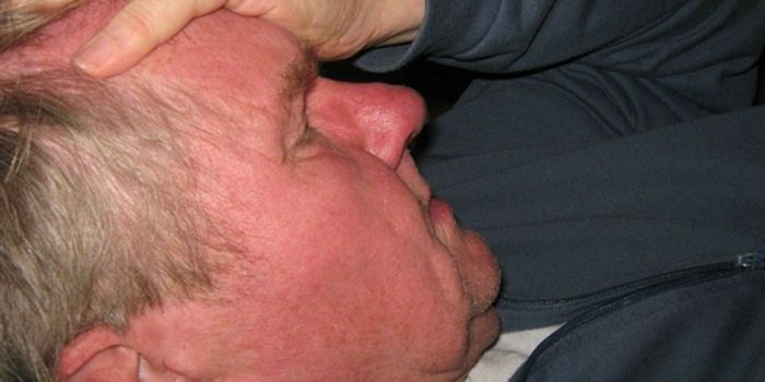 Body Mass Index Could Be a Migraine Risk Factor