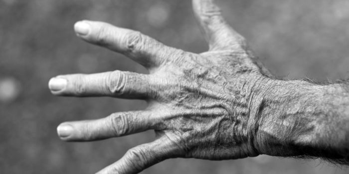 Arthritis Drug Approved for Critically Ill COVID Patients