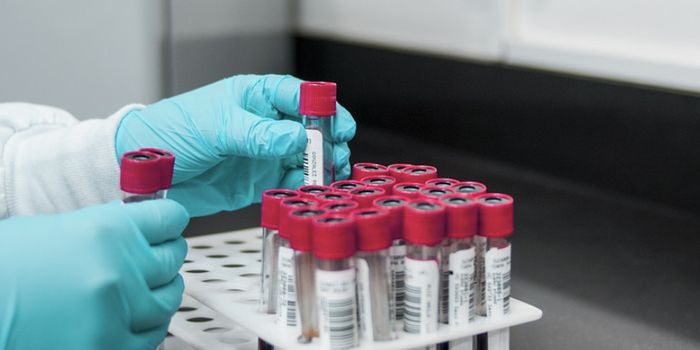A New Blood Test Could Make Diagnosing Fibromyalgia Much Easier