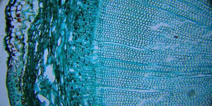 Novel Molecular "Switch" Drives Cancer Growth