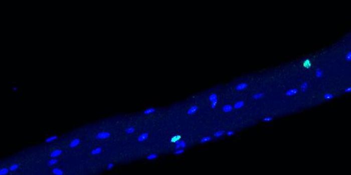 Investigating the Many Nuclei in Muscle Cells