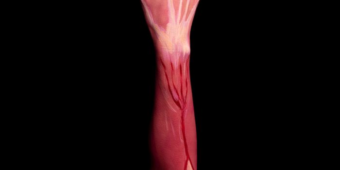 New Neurotech Stimulates Spinal Cord to Improve Arm Mobility After Stroke