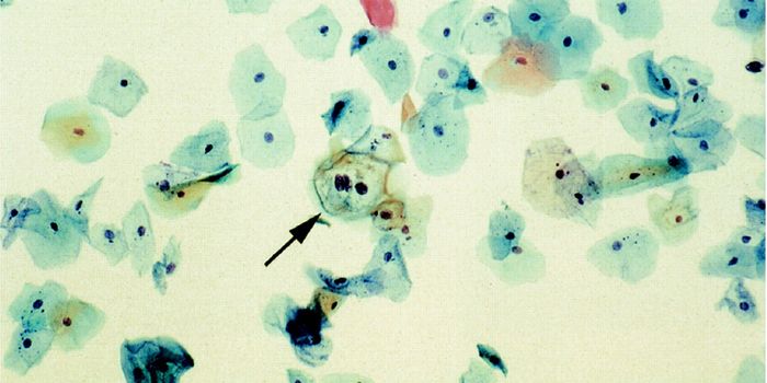 Incremental Strides Made in Women's Health & Cancer Care