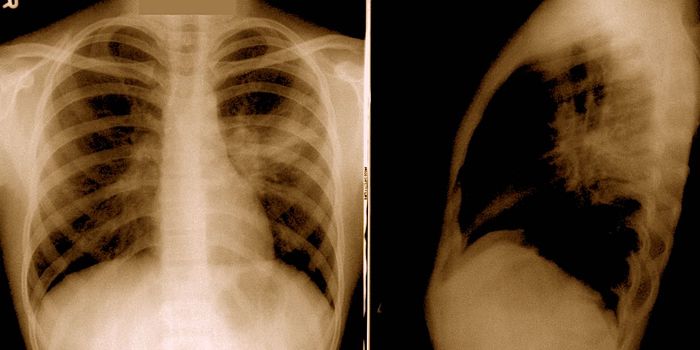 Over 200 Volunteers Design $216 Ventilator for COVID-19