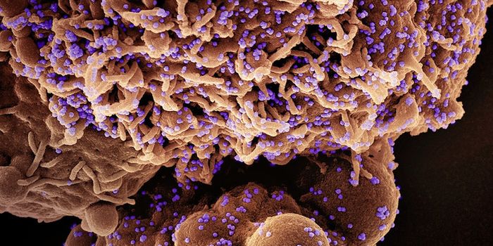 Long COVID Has a Unique Blood Plasma Protein Signature