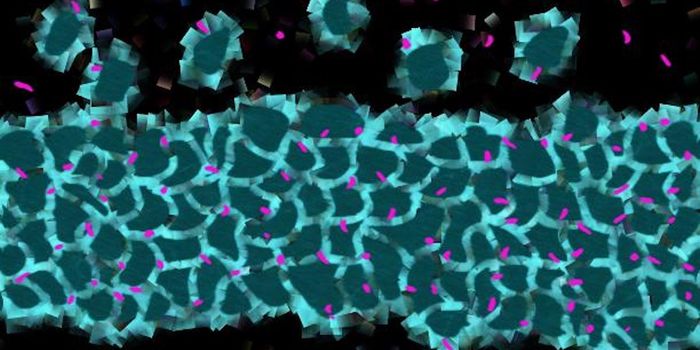 Fragile X Model Has a Very Specific Brain Abnormality