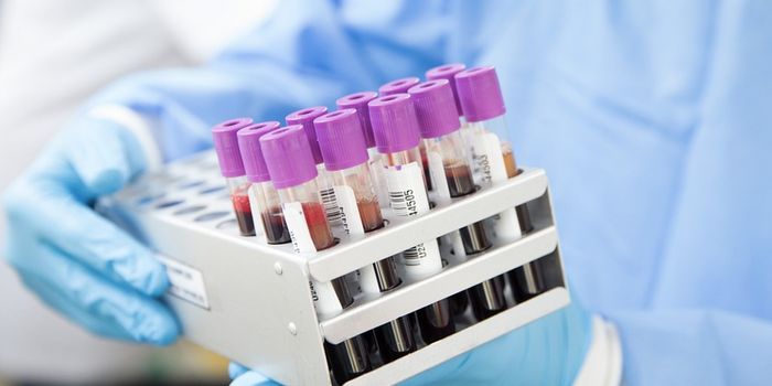 New Approaches May Improve the Diagnosis of ALS