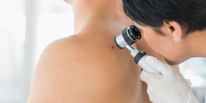 Artificial Mole Tattoo for Early Cancer Detection