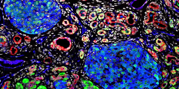 'Sugar-coating' proteins to treat pancreatitis?