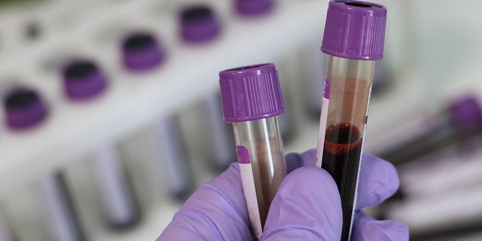 Mitochondrial Dysfunction May Raise Schizophrenia Risk in 22q Patients