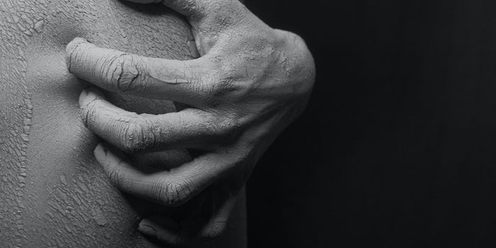 Gene Silencing Therapy Stops the Itch of Psoriasis