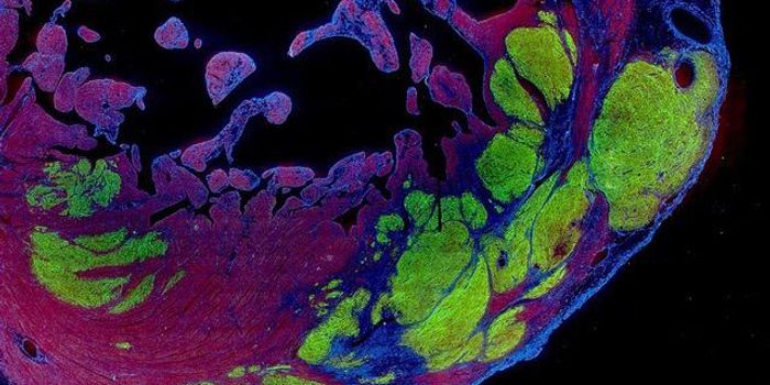 Stem Cell Treatment Restores Failing Macaque Monkey Hearts