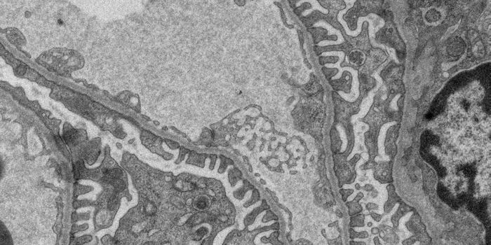 Why Lithium Can Have a Negative Impact on the Kidney