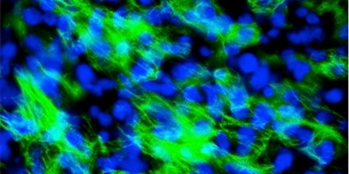 Lab-Grown Heart Cells Thump With a Jolt