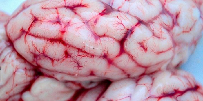 New Advances In Treatment of Aggressive Brain Tumors