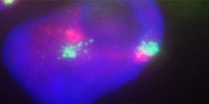 New Insight Into X Chromosome Inactivation in Humans