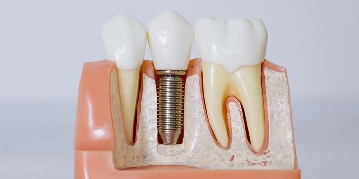 Gum Disease and Tooth Loss Linked to Shrinking Hippocampus