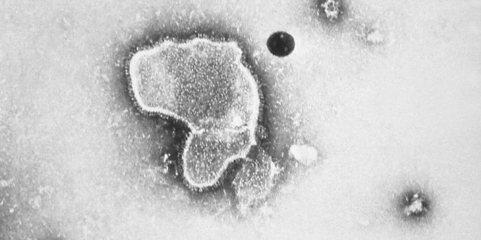 RSV Infections Can Modify Host Immune Gene Activity