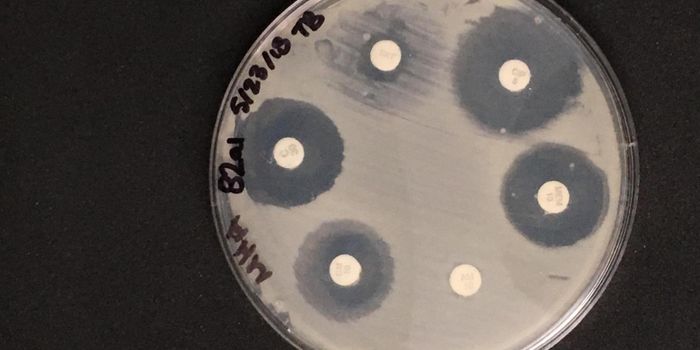 Dust with High Levels of Triclosan has More Antibiotic Resistance Genes