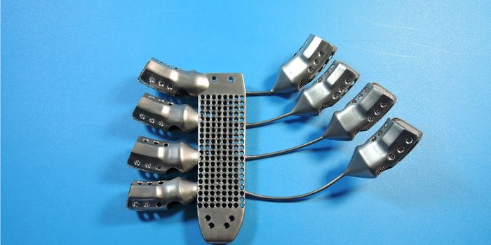 54 Year-Old Cancer Patient Receives 3D-Printed Ribs & Sternum