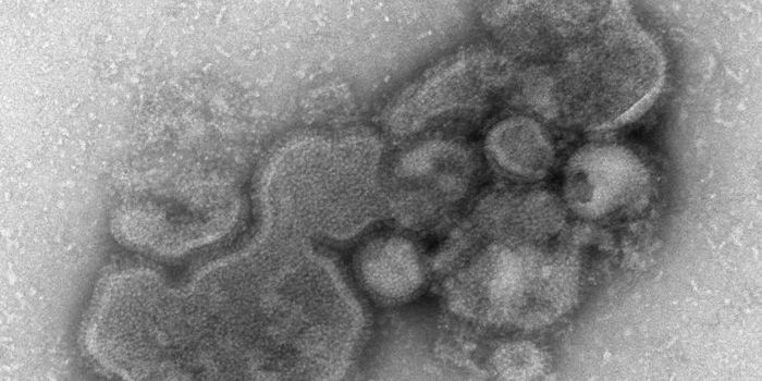 Rare Genetic Variant Can Make People Susceptible to Bird Flu H7N9