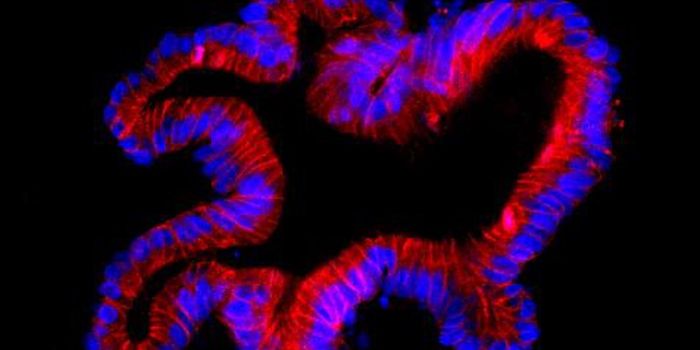 A Toxin Produced by C.difficile Can Damage Intestinal Stem Cells
