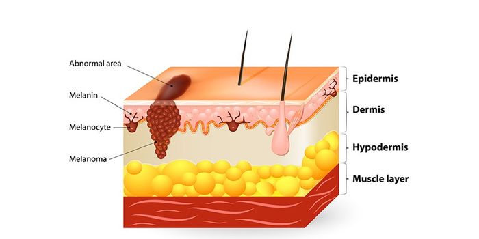 Widely-Used Drug Contributed To Skin Cancer